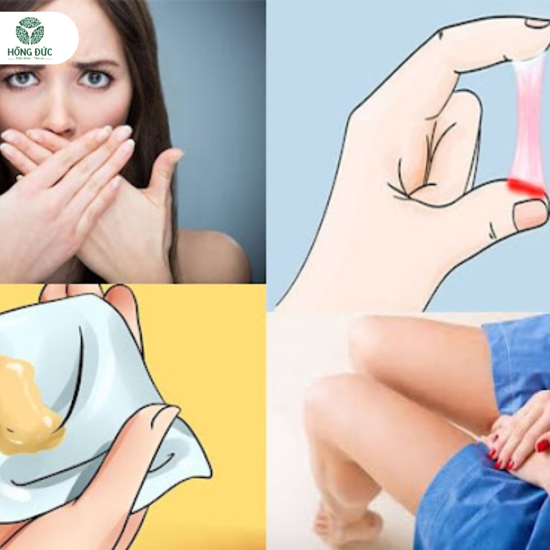 Nguyên nhân hình thành viêm lộ tuyến cổ tử cung và cách điều trị lộ tuyến cổ tử cung an toàn, hiệu quả 3 Nguyên nhân hình thành viêm lộ tuyến cổ tử cung