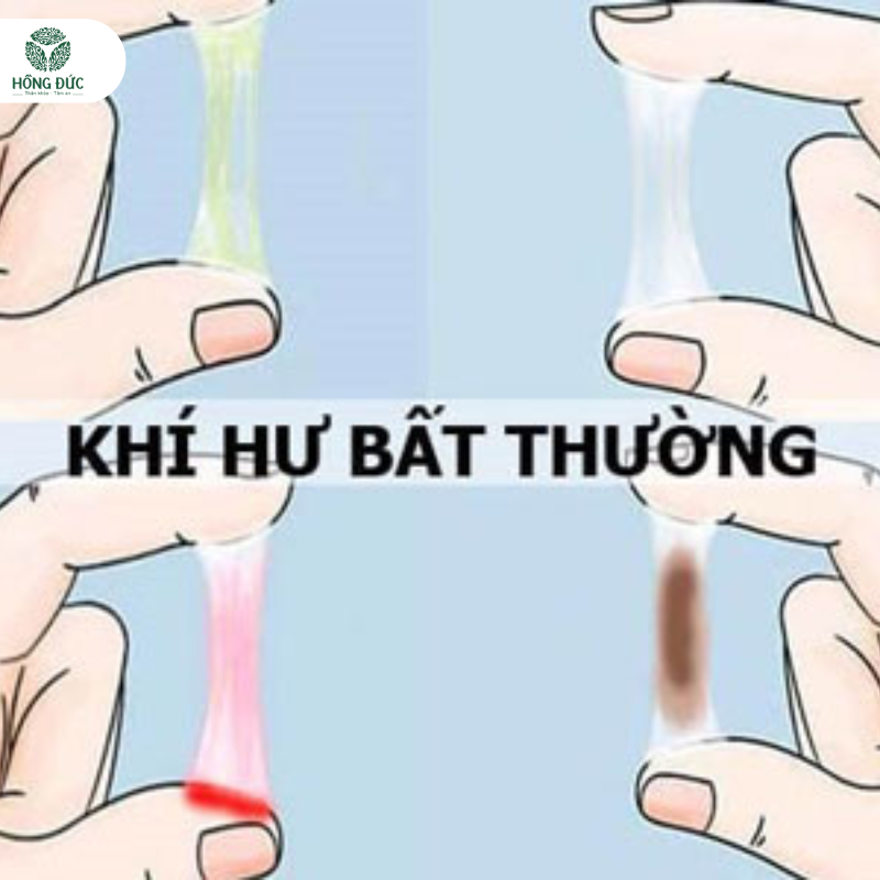 Điều trị viêm lộ tuyến bằng Samya: Giải pháp tự nhiên, hiệu quả cho phụ nữ hiện đại 4 4