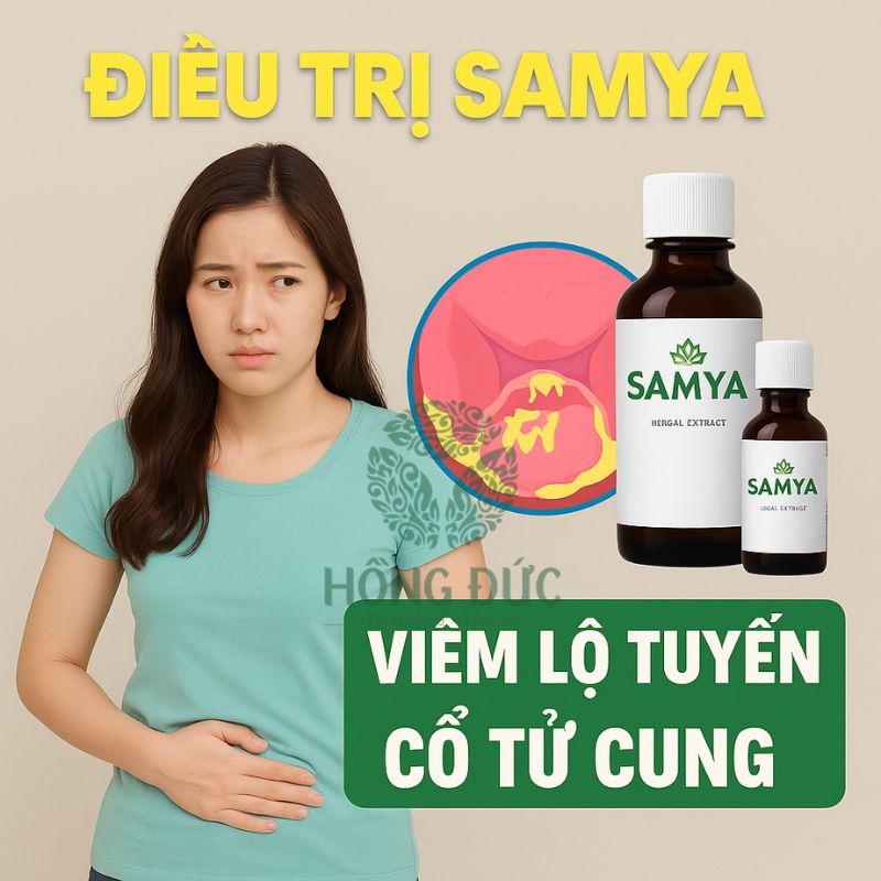 Điều trị viêm lộ tuyến bằng Samya: Giải pháp tự nhiên, hiệu quả cho phụ nữ hiện đại 5 Viem lo tuyen co tu cung 19