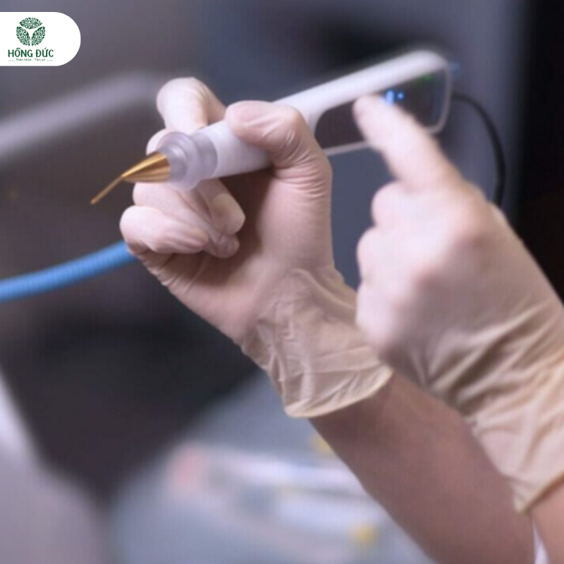 Cách điều trị viêm lộ tuyến cổ tử cung hiệu quả: Từ thuốc đến công nghệ hiện đại 18 Phương pháp điều trị Viêm Lộ Tuyến Cổ Tử Cung